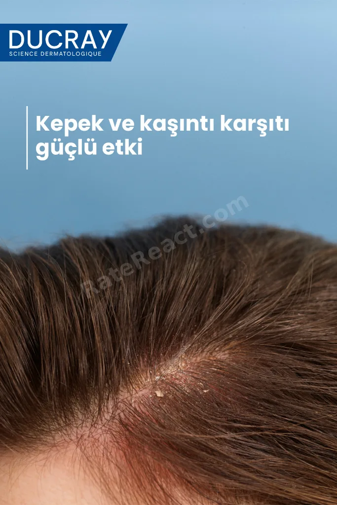 Kelual DS İnatçı Kepek Karşıtı Şampuan Kepeğe Karşı Etkili ve Hassas Saç Derisi için 100 ml