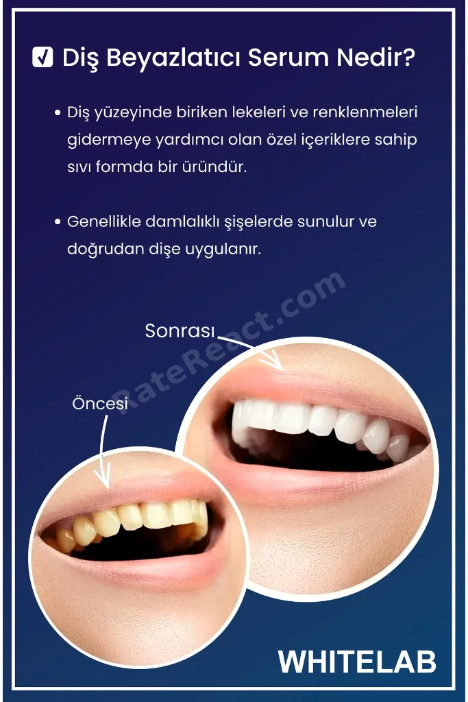 Diş Beyazlatıcı Solüsyon 2x10 ml