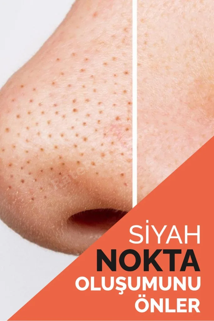 Collagen Ölüdeniz Kil Maskesi Leke,giderici Akne Ve Siyah Nokta Giderici Maske 150gr