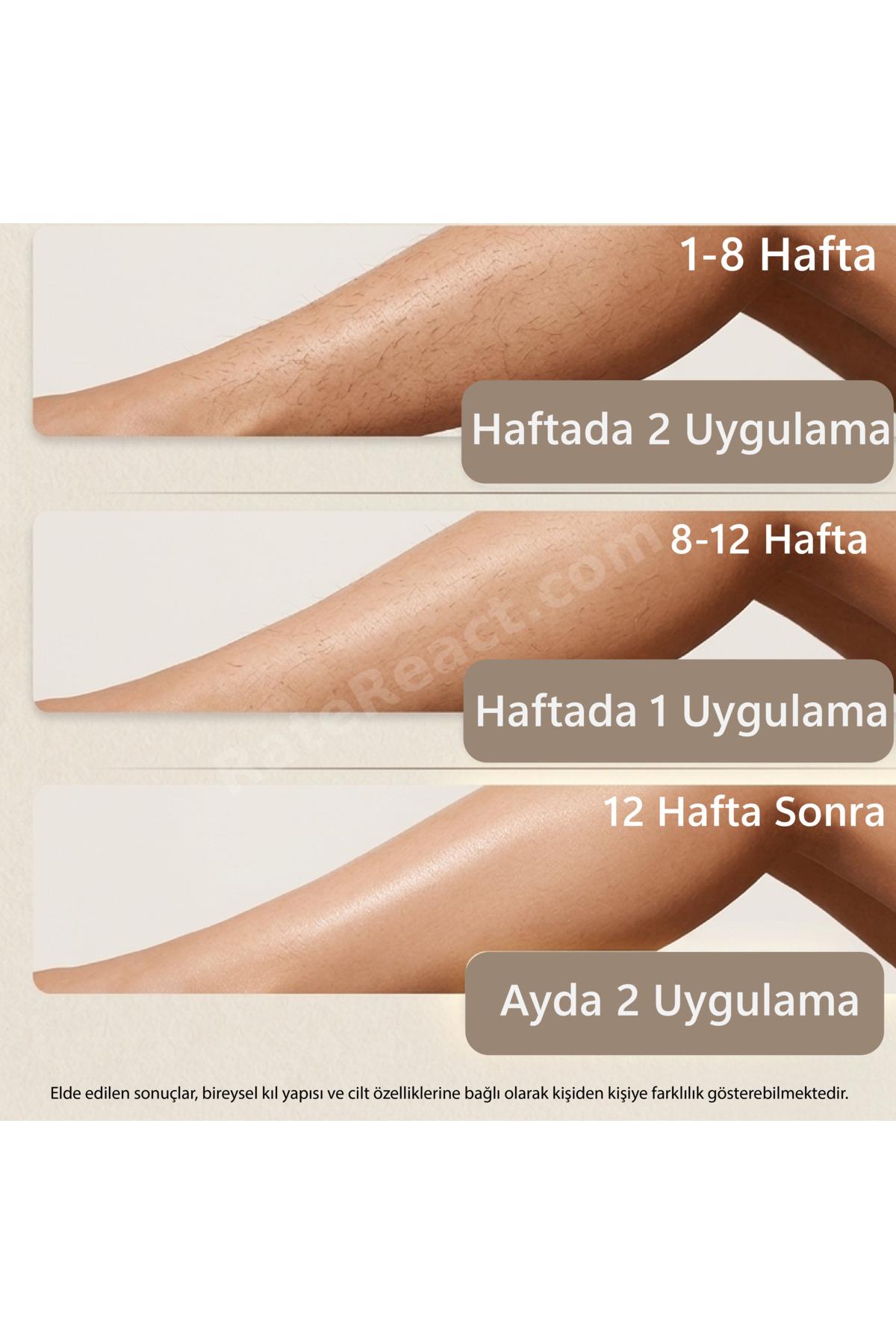 A2030 IPL YENİ Sapphire Sogutma 35 joule Ultra Güç -Acısız Etki- Çoklu Otomatik Seri Atım-Kadın-Erkek