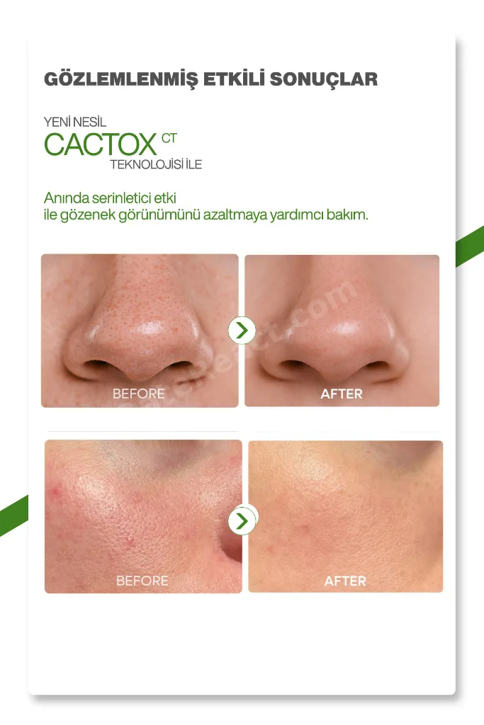 Kaktüs Özlü | Gözenek Sıkılaştırıcı | Serinletici | Cactox Multi Balm 25gr