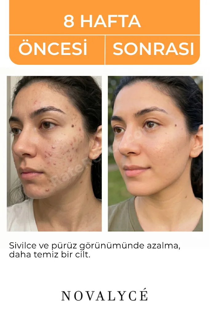 Glikolik Asit Tonik Cilt Yenileyici ve Gözenek Sıkılaştırıcı Tüm Ciltler Için