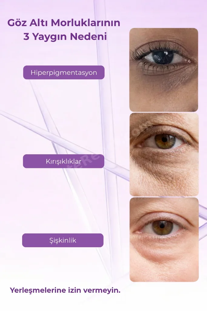Vionine Retinal A Night Eye Cream / Gece Göz Kremi