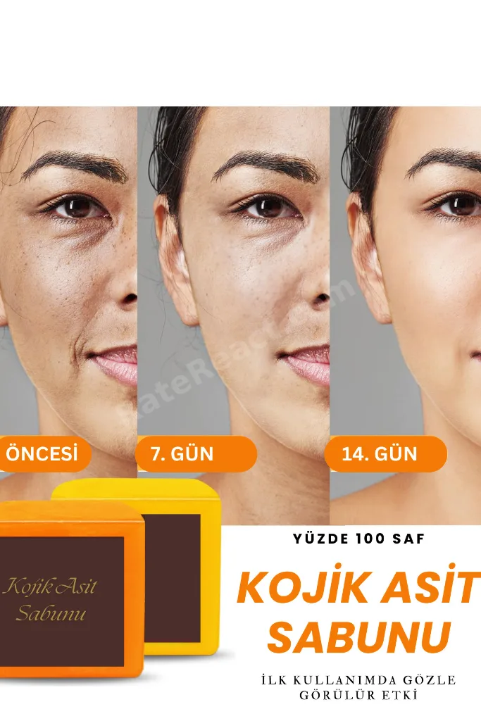 Yüksek Asit Oranlı Kojic Asit Sabunu (Zerdeçal Ve Kojik Asit) Leke Karşıtı Kojik Asit Sabunu
