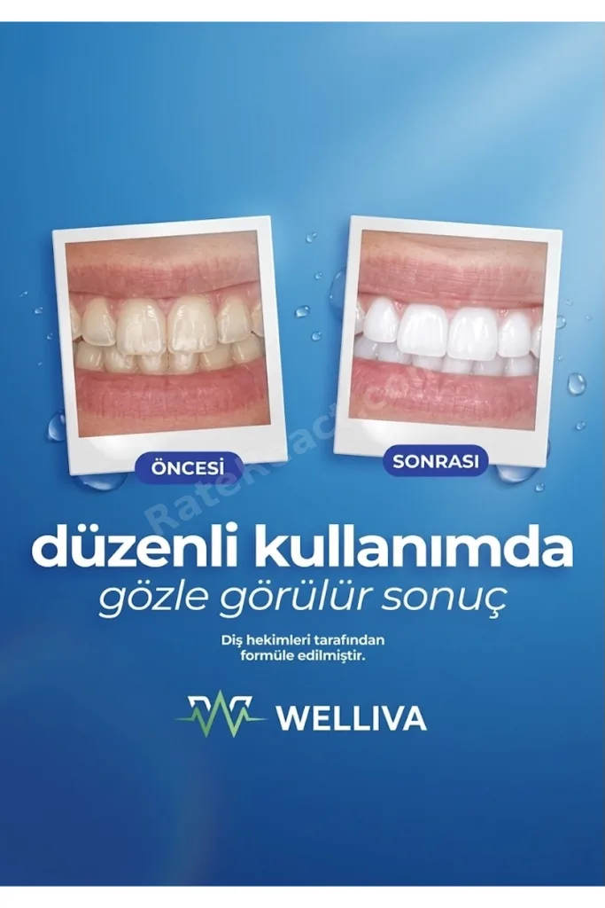 Diş Beyazlatma Bandı 28’li – Anında Etkili Beyazlatma (Teeth Whitening Strip)