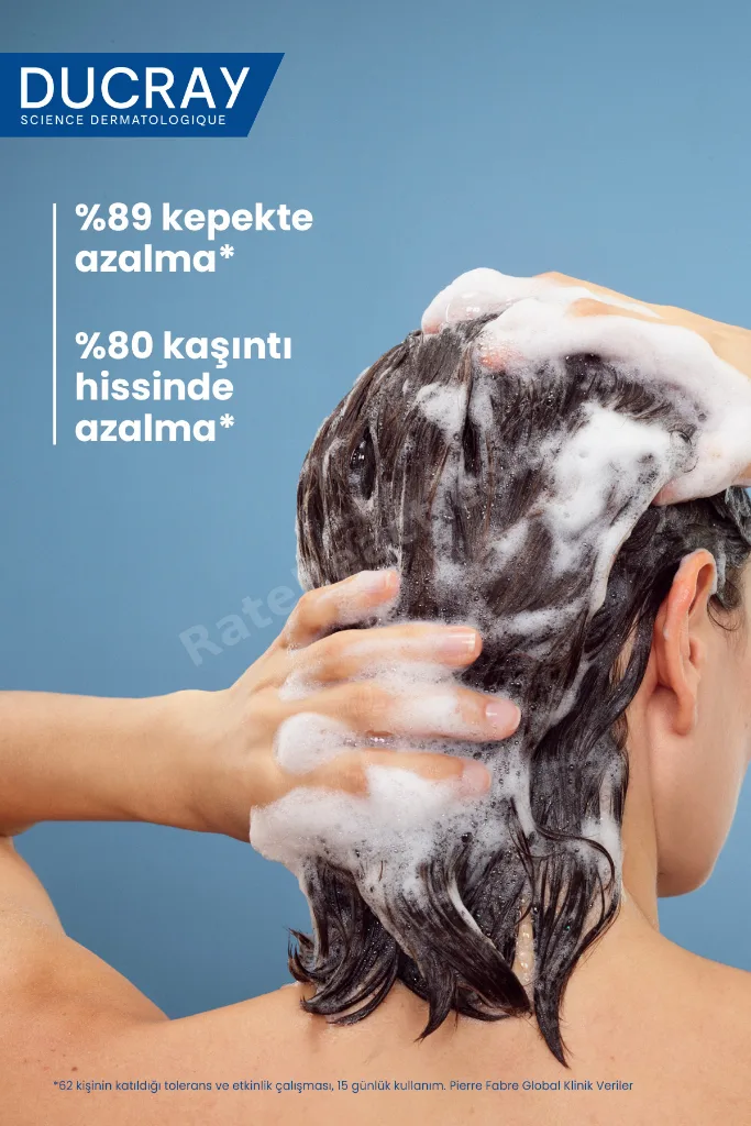 Kelual DS İnatçı Kepek Karşıtı Şampuan Kepeğe Karşı Etkili ve Hassas Saç Derisi için 100 ml