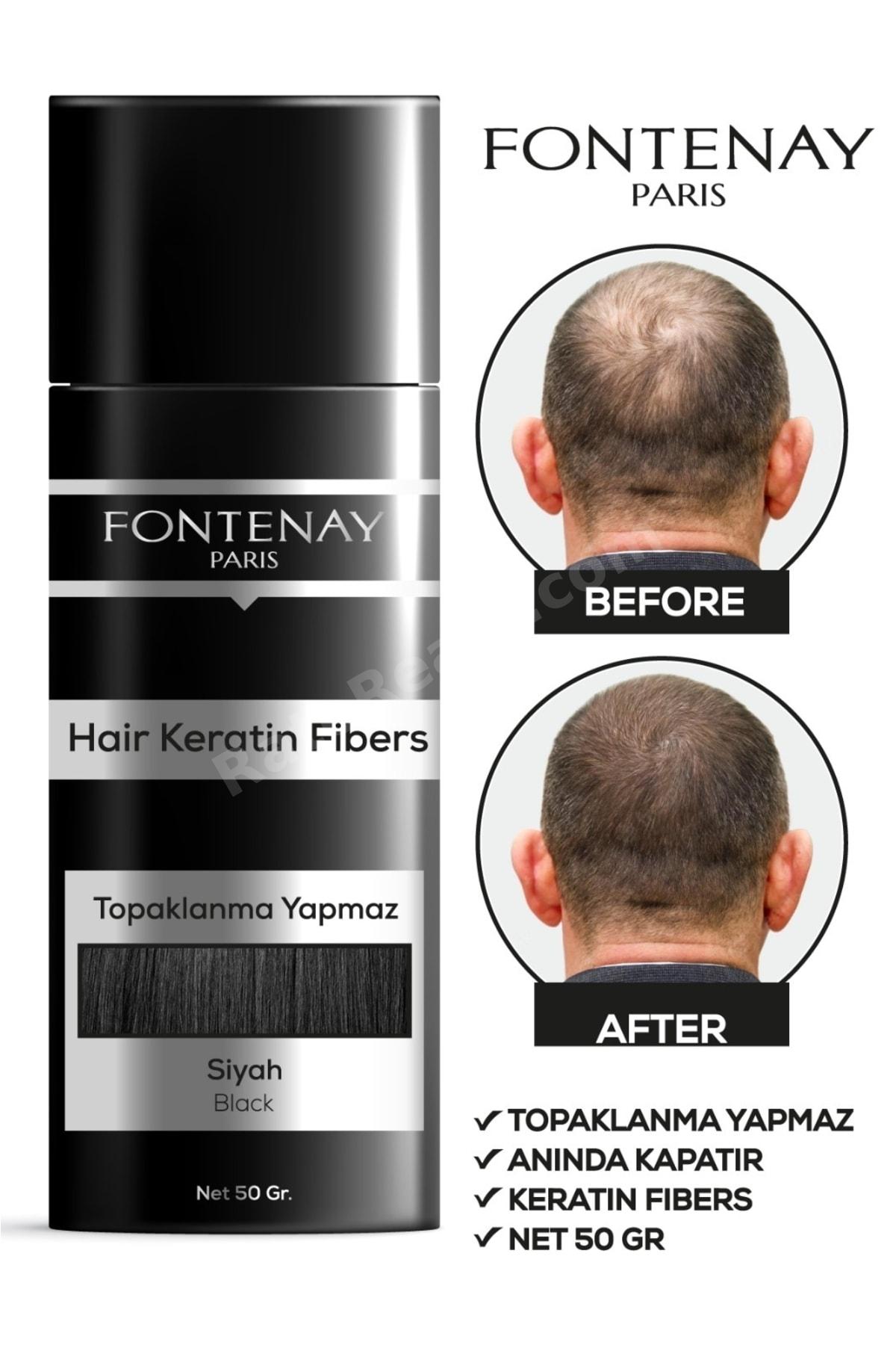 Saç Dolgunlaştırıcı Keratin Fibers Siyah Topik Saç Tozu 50gr