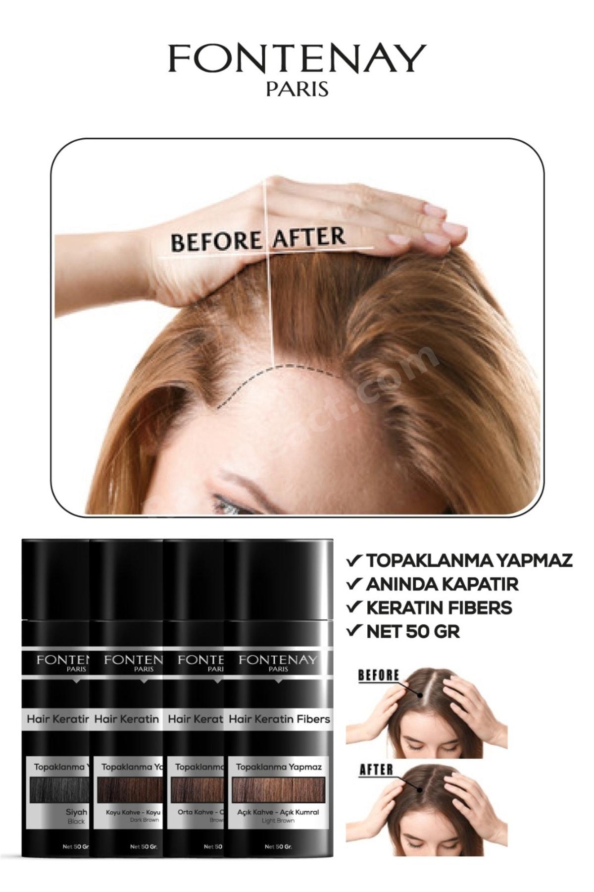 Saç Dolgunlaştırıcı Keratin Fibers Siyah Topik Saç Tozu 50gr